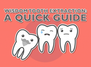 Wisdom Tooth Extraction: A Quick Guide