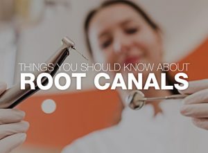 Things You Should Know about Root Canals